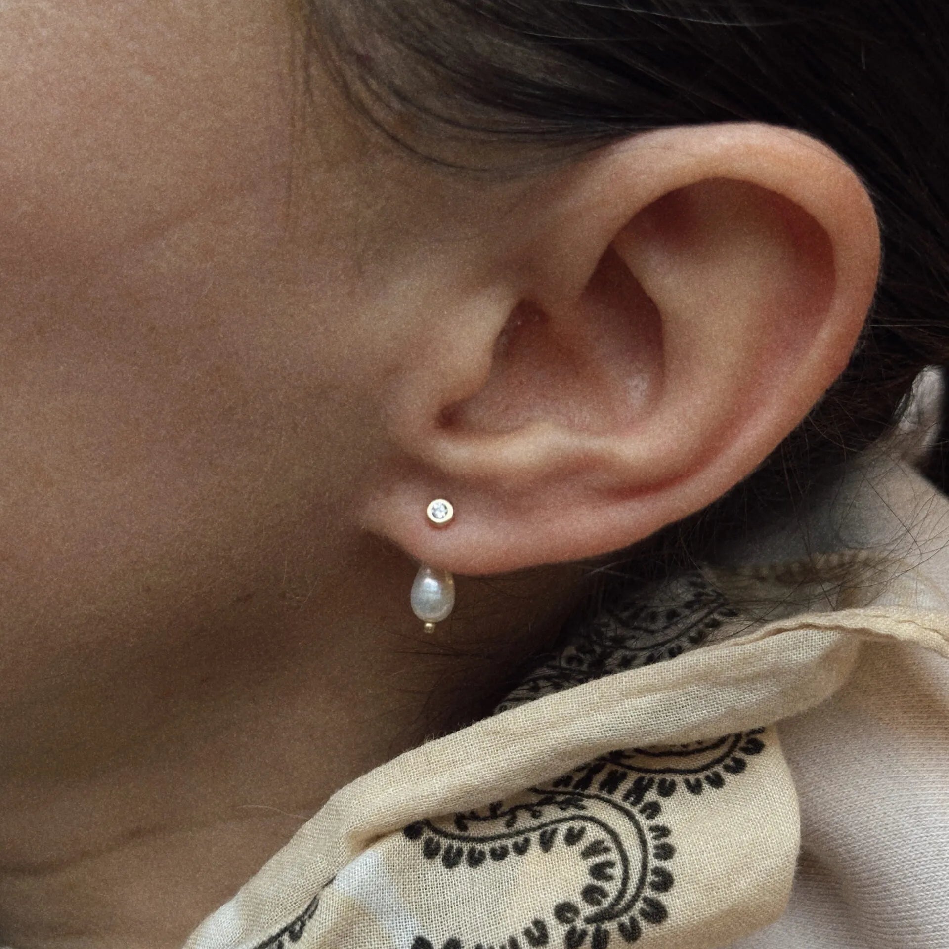 Diamante de Aquiles